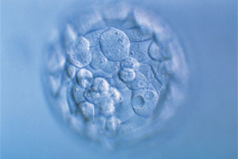 http://dongguan.quanwangkm.com/post/190.html|东莞人工试管